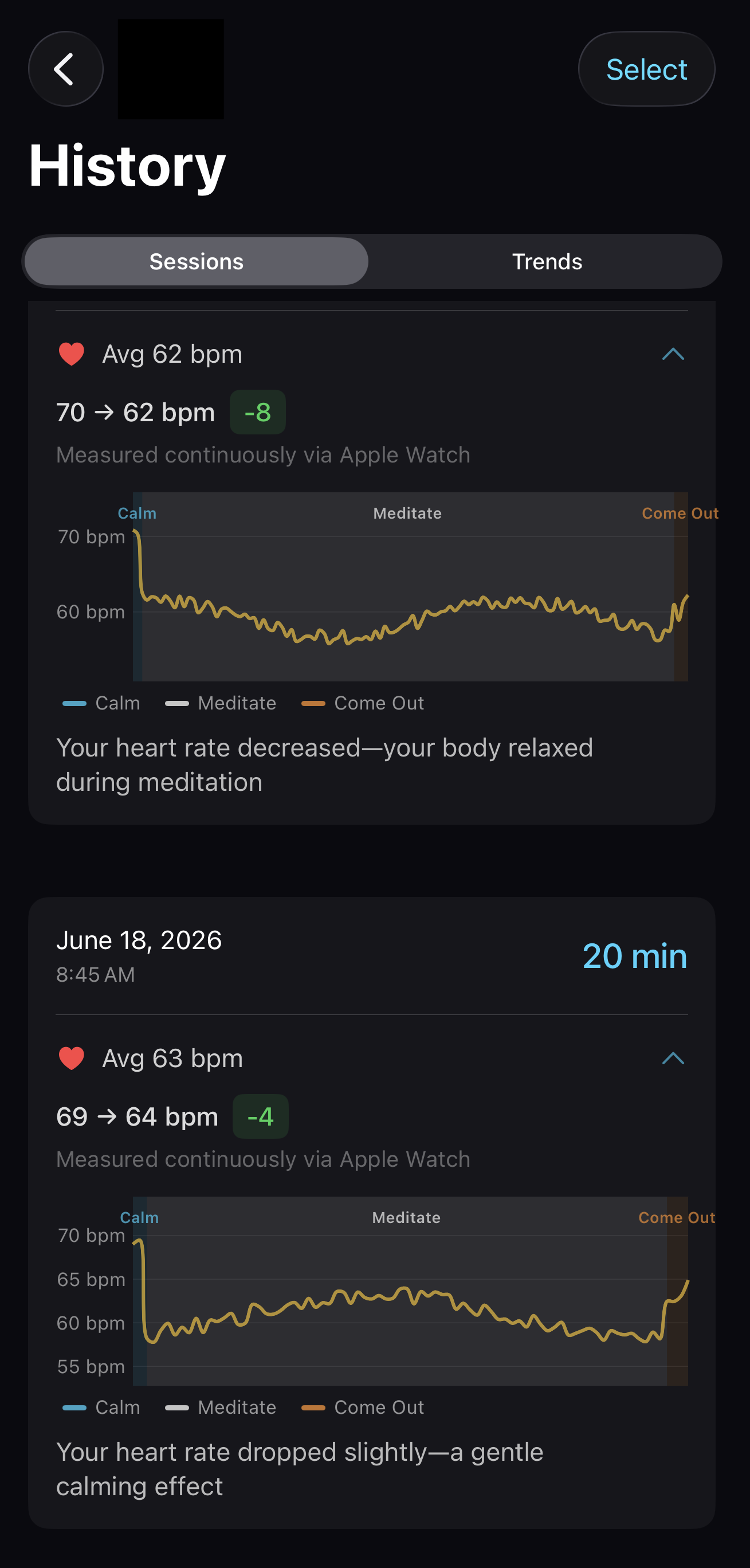 Tera 7.83 session history with heart rate charts